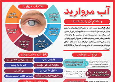 آب مروارید و علائم آن را بشناسید