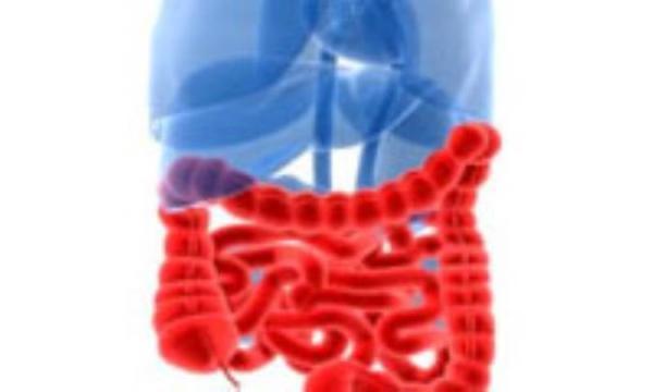 سندرم روده تحریک پذیر سندرم روده تحریک پذیر